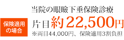 当院の眼瞼下垂保険診療片目約23,100円